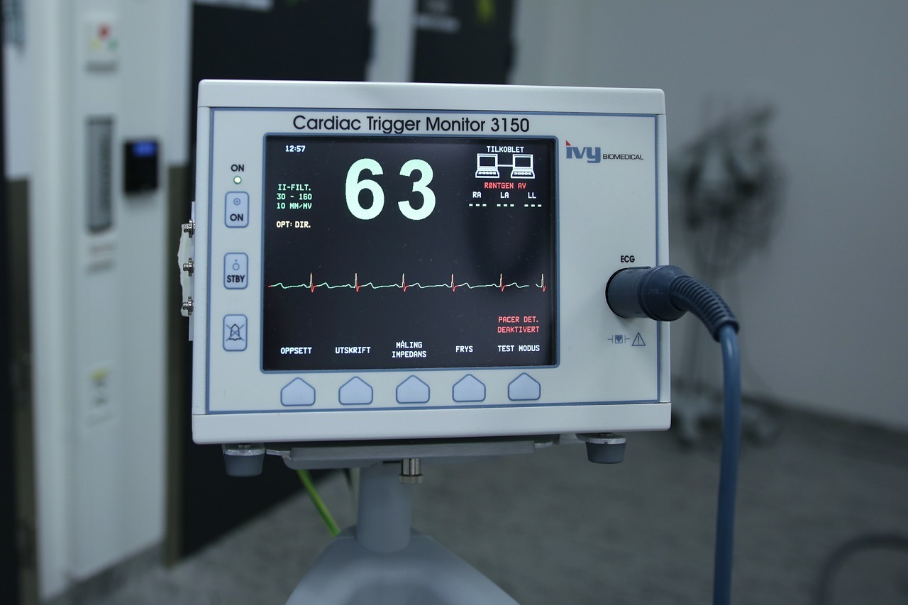 Vad är EKG och hur fungerar det?
